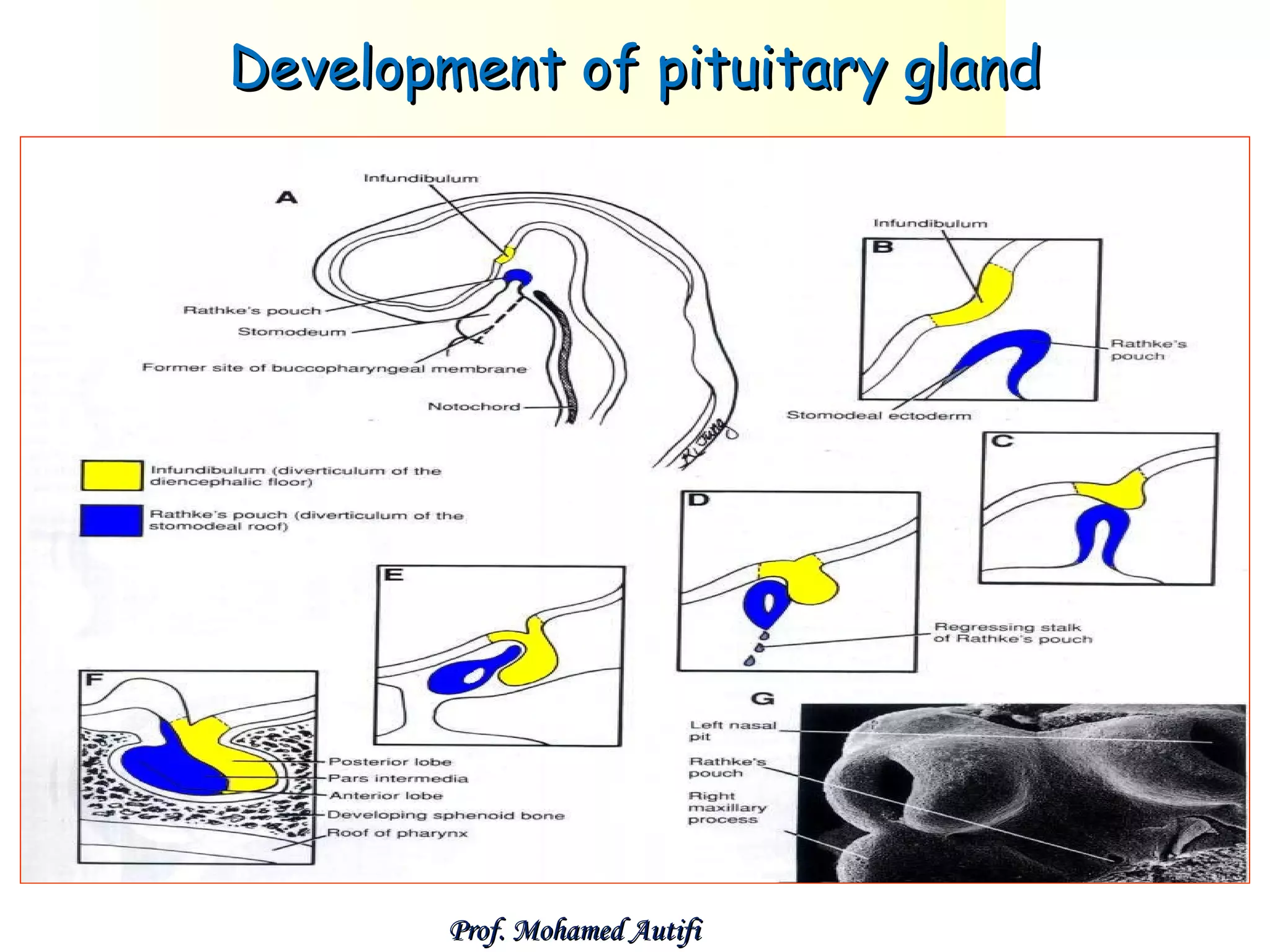 Development of pituitary gland

Prof. Mohamed Autifi

 