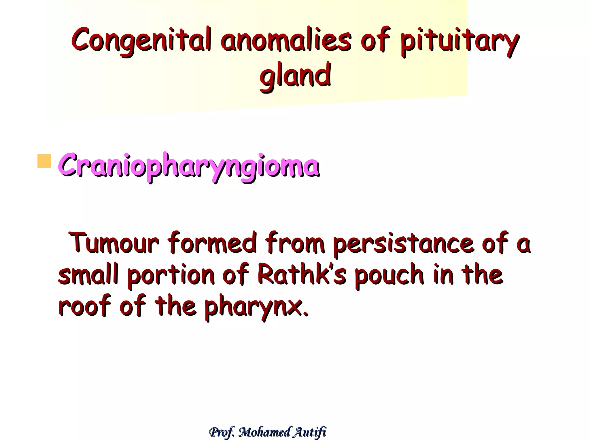 Congenital anomalies of pituitary
gland
 Craniopharyngioma

Tumour formed from persistance of a
small portion of Rathk’s pouch in the
roof of the pharynx.

Prof. Mohamed Autifi

 