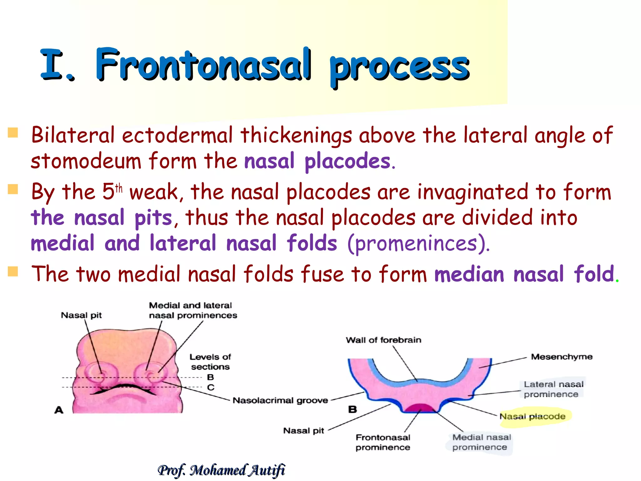 I. Frontonasal process





Bilateral ectodermal thickenings above the lateral angle of
stomodeum form the nasal placodes.
By the 5th weak, the nasal placodes are invaginated to form
the nasal pits, thus the nasal placodes are divided into
medial and lateral nasal folds (promeninces).
The two medial nasal folds fuse to form median nasal fold.

Prof. Mohamed Autifi

 