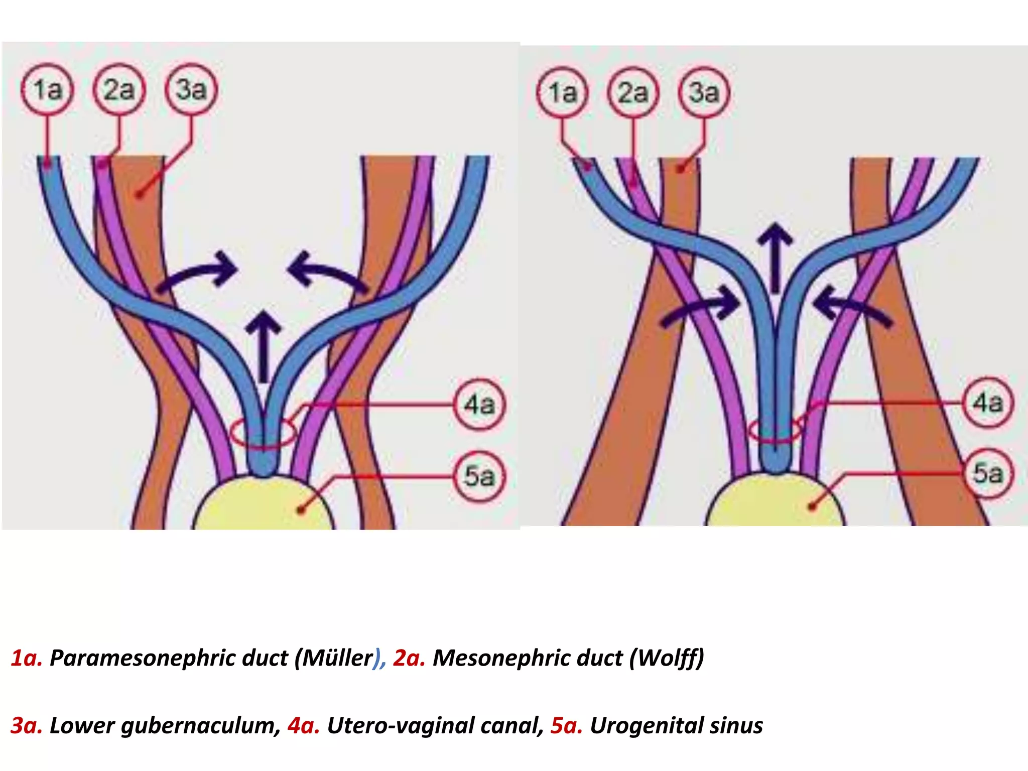 Formation of the uterus (7th – 8th wks of IUL)
1a. Paramesonephric duct (Müller), 2a. Mesonephric duct (Wolff)
3a. Lower gubernaculum, 4a. Utero-vaginal canal, 5a. Urogenital sinus
 