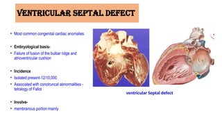 Vsd Incedence DEVELOPMENT OF THE INTERVENTRICULAR SEPTUM.pptx