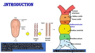 DEVELOPMENT OF THE INTERVENTRICULAR SEPTUM.pptx
