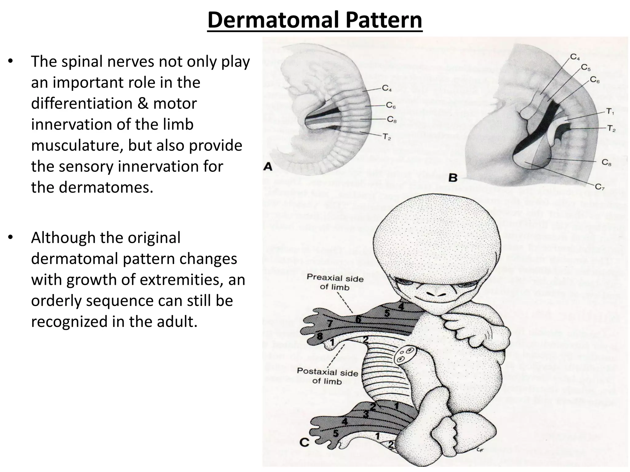 Dermatomal Pattern 
•The spinal nerves not only play an important role in the differentiation & motor innervation of the limb musculature, but also provide the sensory innervation for the dermatomes. 
•Although the original dermatomal pattern changes with growth of extremities, an orderly sequence can still be recognized in the adult. 