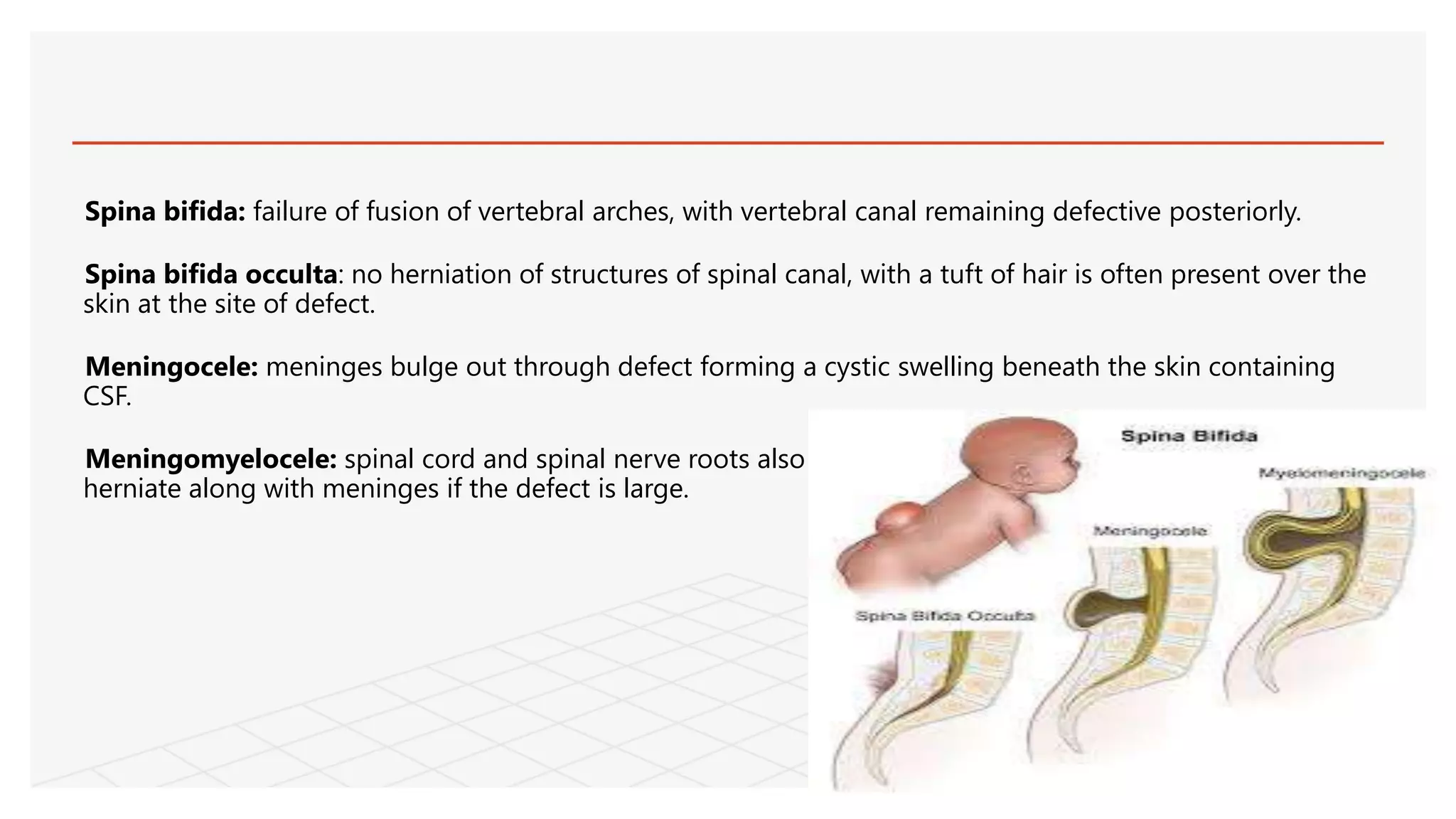Spina bifida: failure of fusion of vertebral arches, with vertebral canal remaining defective posteriorly.
Spina bifida occulta: no herniation of structures of spinal canal, with a tuft of hair is often present over the
skin at the site of defect.
Meningocele: meninges bulge out through defect forming a cystic swelling beneath the skin containing
CSF.
Meningomyelocele: spinal cord and spinal nerve roots also
herniate along with meninges if the defect is large.
 