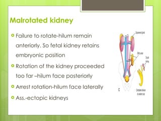 Kidney Rotation DEVELOPMENT OF THE RENAL SYSTEM -Undergraduate 2022 Reviewed.ppt