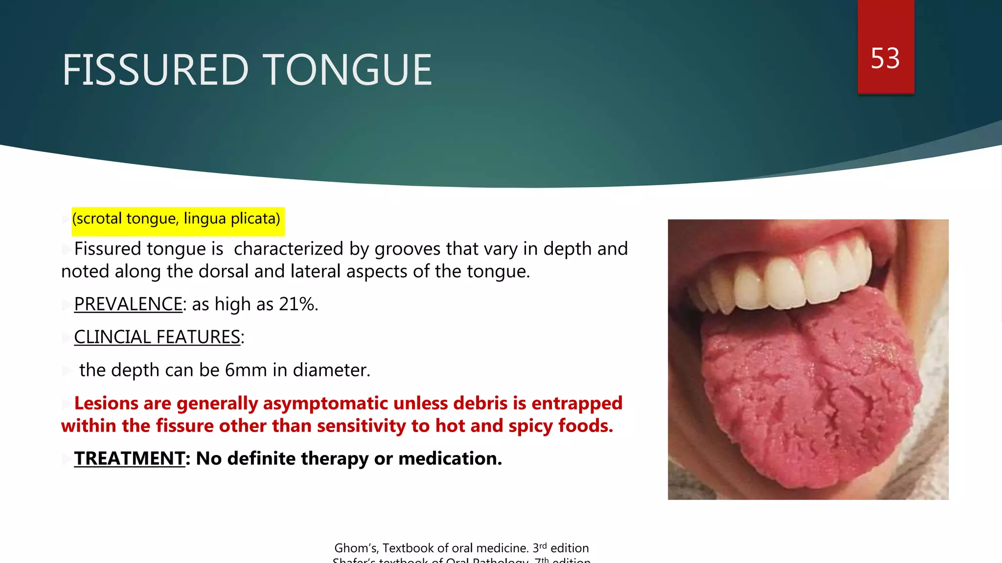 FISSURED TONGUE 53
(scrotal tongue, lingua plicata)
Fissured tongue is characterized by grooves that vary in depth and
noted along the dorsal and lateral aspects of the tongue.
PREVALENCE: as high as 21%.
CLINCIAL FEATURES:
 the depth can be 6mm in diameter.
Lesions are generally asymptomatic unless debris is entrapped
within the fissure other than sensitivity to hot and spicy foods.
TREATMENT: No definite therapy or medication.
Ghom’s, Textbook of oral medicine. 3rd edition
 