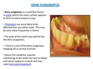 DENS EVAGINATUS
• Dens evaginatus is a condition found
in teeth where the outer surface appears
to form an extra bump or cusp.
• Premolars are more likely to be
affected than any other tooth. This may
be seen more frequently in Asians
• The pulp of the tooth may extend into
the dens evaginatus.
• There is a risk of the dens evaginatus
chipping off in normal function
• Hence this condition requires
monitoring as the tooth can lose its blood
and nerve supply as a result and may
need root canal treatment.
 