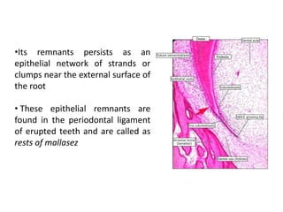 •Its remnants persists as an
epithelial network of strands or
clumps near the external surface of
the root
• These epithelial remnants are
found in the periodontal ligament
of erupted teeth and are called as
rests of mallasez
 