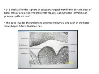 • 2- 3 weeks after the rupture of buccopharyngeal membrane, certain areas of
basal cells of oral ectoderm proliferate rapidly, leading to the formation of
primary epithelial band
• The band invades the underlying ectomesenchyme along each of the horse-
shoe shaped future dental arches.
 