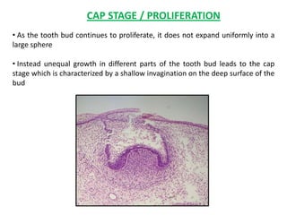 CAP STAGE / PROLIFERATION
• As the tooth bud continues to proliferate, it does not expand uniformly into a
large sphere

• Instead unequal growth in different parts of the tooth bud leads to the cap
stage which is characterized by a shallow invagination on the deep surface of the
bud
 