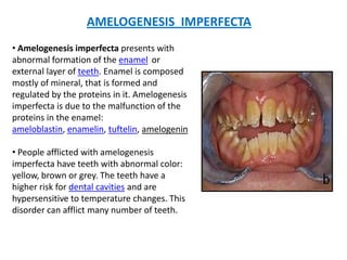 AMELOGENESIS IMPERFECTA
• Amelogenesis imperfecta presents with
abnormal formation of the enamel or
external layer of teeth. Enamel is composed
mostly of mineral, that is formed and
regulated by the proteins in it. Amelogenesis
imperfecta is due to the malfunction of the
proteins in the enamel:
ameloblastin, enamelin, tuftelin, amelogenin

• People afflicted with amelogenesis
imperfecta have teeth with abnormal color:
yellow, brown or grey. The teeth have a
higher risk for dental cavities and are
hypersensitive to temperature changes. This
disorder can afflict many number of teeth.
 