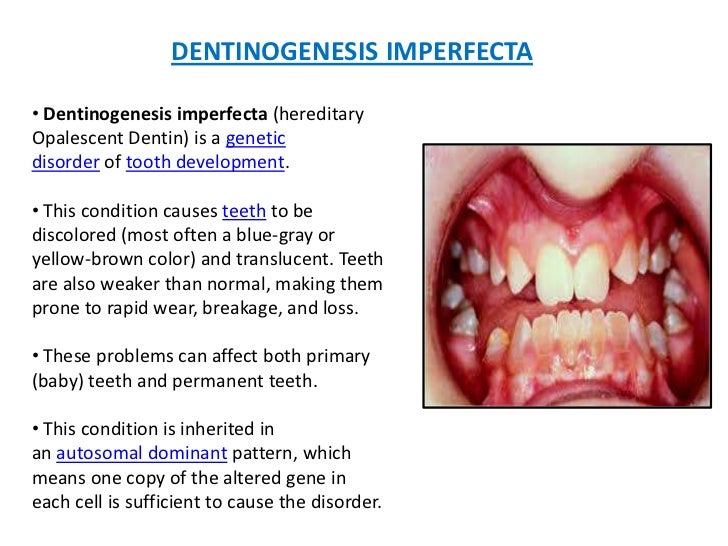 Development of tooth