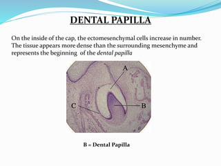DENTAL PAPILLA 
On the inside of the cap, the ectomesenchymal cells increase in number. 
The tissue appears more dense than the surrounding mesenchyme and 
represents the beginning of the dental papilla 
B = Dental Papilla 
 