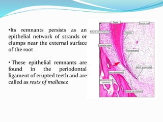 •Its remnants persists as an 
epithelial network of strands or 
clumps near the external surface 
of the root 
• These epithelial remnants are 
found in the periodontal 
ligament of erupted teeth and are 
called as rests of mallasez 
 