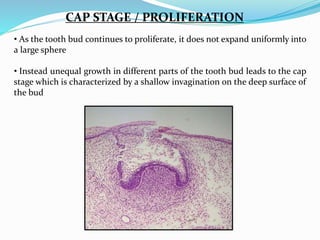 CAP STAGE / PROLIFERATION
• As the tooth bud continues to proliferate, it does not expand uniformly into
a large sphere
• Instead unequal growth in different parts of the tooth bud leads to the cap
stage which is characterized by a shallow invagination on the deep surface of
the bud
 