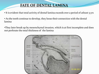 FATE OF DENTAL LAMINA
• It is evident that total activity of dental lamina exceeds over a period of atleast 5 yrs
• As the teeth continue to develop, they loose their connection with the dental
lamina
•They later break up by mesenchymal invasion, which is at first incomplete and does
not perforate the total thickness of the lamina
 