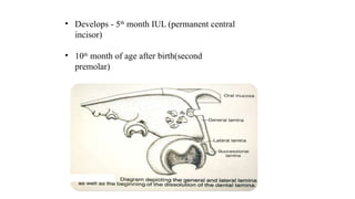 • Develops - 5th
month IUL (permanent central
incisor)
• 10th
month of age after birth(second
premolar)
 