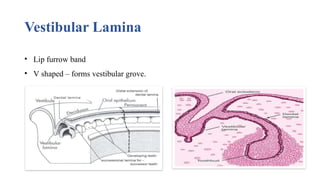 Vestibular Lamina
• Lip furrow band
• V shaped – forms vestibular grove.
 