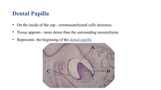 Dental Papilla
• On the inside of the cap - ectomesenchymal cells increases.
• Tissue appears - more dense than the surrounding mesenchyme
• Represents the beginning of the dental papilla
 