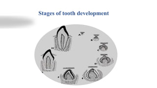 Stages of tooth development
 