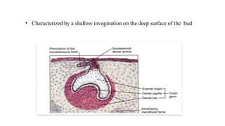 • Characterized by a shallow invagination on the deep surface of the bud
 