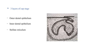  3 layers of cap stage
• Outer dental epithelium
• Inner dental epithelium
• Stellate reticulum
 