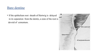 Bare dentine
• If the epithelium root sheath of Hertwig is delayed
in its separation from the dentin, a zone of the root is
devoid of cementum.
 