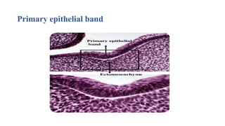 Primary epithelial band
 