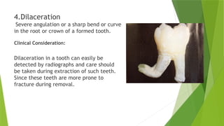 Development of Tooth and developmental anomaly of tooth.pptx
