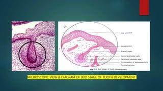 MICRIOSCOPIC VIEW & DIAGRAM OF BUD STAGE OF TOOTH DEVELOPMENT
 