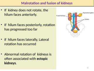Development of urinary system ,2025.pptx