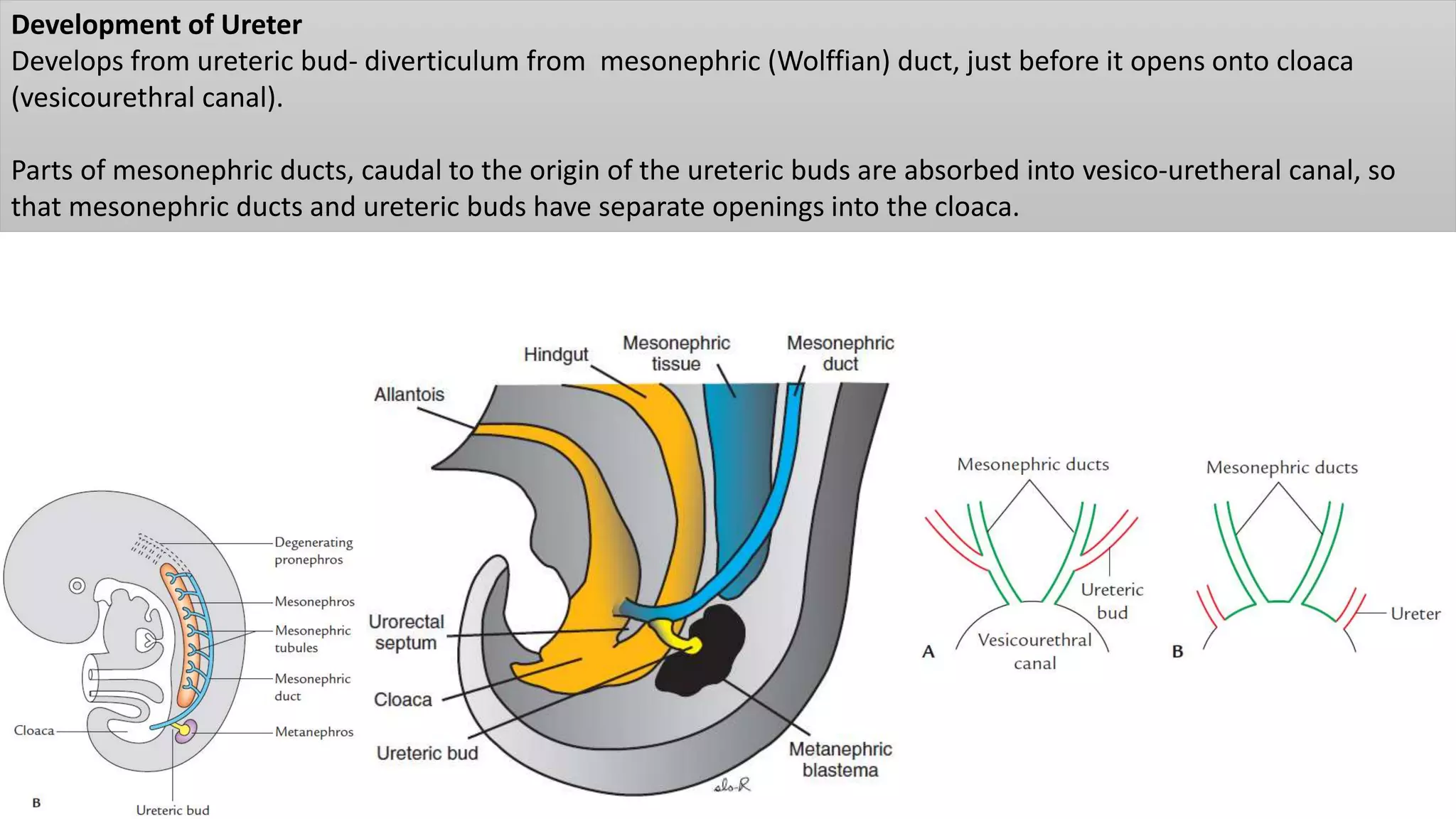 Development of Ureter
Develops from ureteric bud- diverticulum from mesonephric (Wolffian) duct, just before it opens onto cloaca
(vesicourethral canal).
Parts of mesonephric ducts, caudal to the origin of the ureteric buds are absorbed into vesico-uretheral canal, so
that mesonephric ducts and ureteric buds have separate openings into the cloaca.
 
