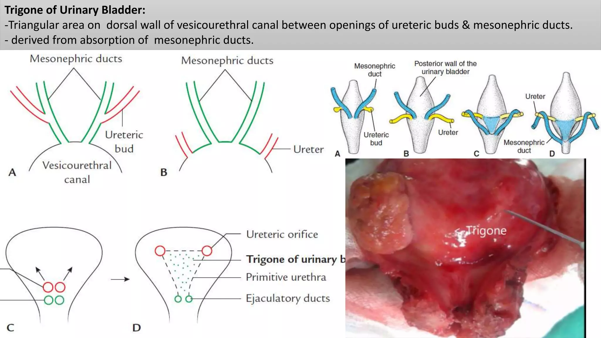 Trigone of Urinary Bladder:
-Triangular area on dorsal wall of vesicourethral canal between openings of ureteric buds & mesonephric ducts.
- derived from absorption of mesonephric ducts.
 