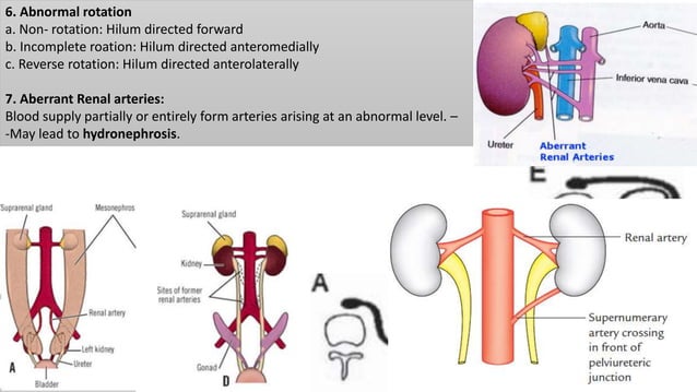 Kidney Rotation Development of urogenital system I | PPTX | Biological Sciences | Science