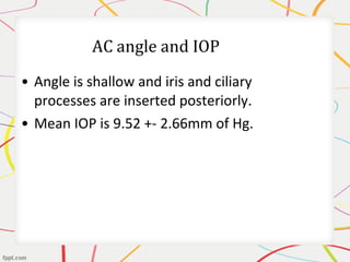 • Angle is shallow and iris and ciliary
processes are inserted posteriorly.
• Mean IOP is 9.52 +- 2.66mm of Hg.
 