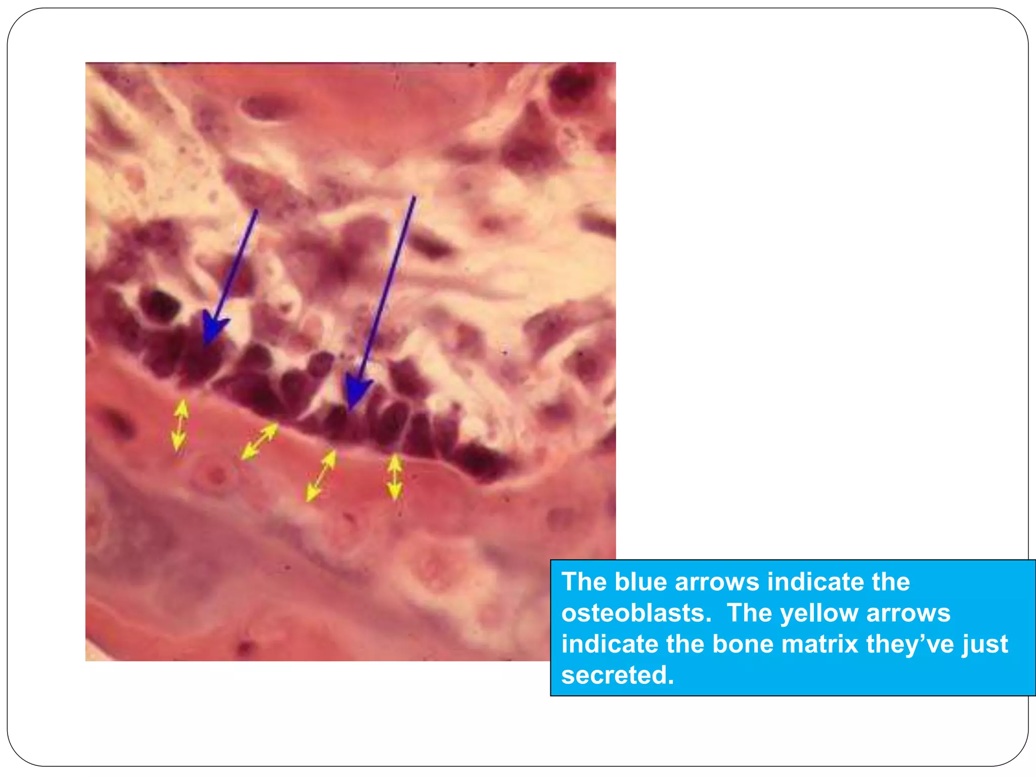 The blue arrows indicate the
osteoblasts. The yellow arrows
indicate the bone matrix they’ve just
secreted.
 