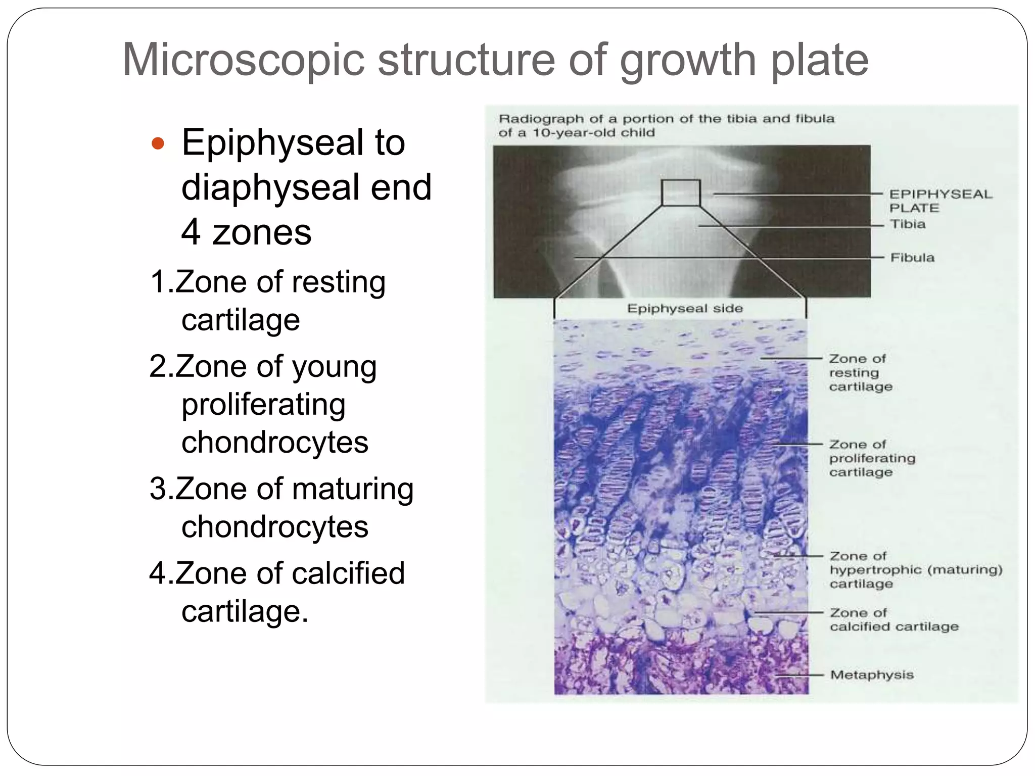 Microscopic structure of growth plate
 Epiphyseal to
diaphyseal end
4 zones
1.Zone of resting
cartilage
2.Zone of young
proliferating
chondrocytes
3.Zone of maturing
chondrocytes
4.Zone of calcified
cartilage.
 