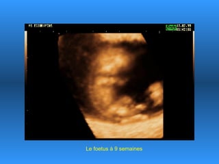 Le foetus à 9 semaines