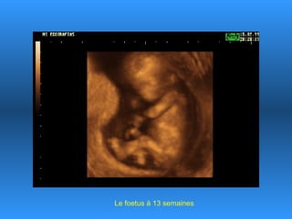Le foetus à 13 semaines