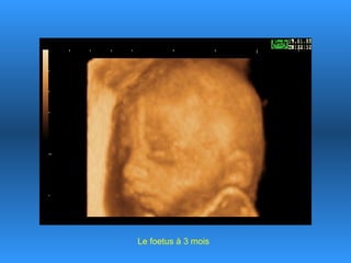 Le foetus à 3 mois