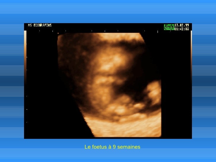 Developpement Du Foetus