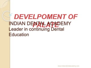 INDIAN DENTAL ACADEMY
Leader in continuing Dental
Education
www.inidiandentalacademy.com
 