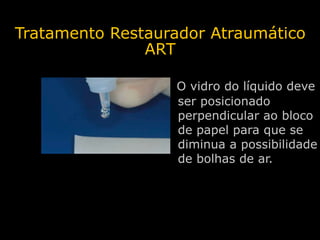 Tratamento Restaurador Atraumático
               ART

                     O vidro do líquido deve
                     s...