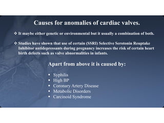 Developmental Anomalies of Cardiac Valves | PDF