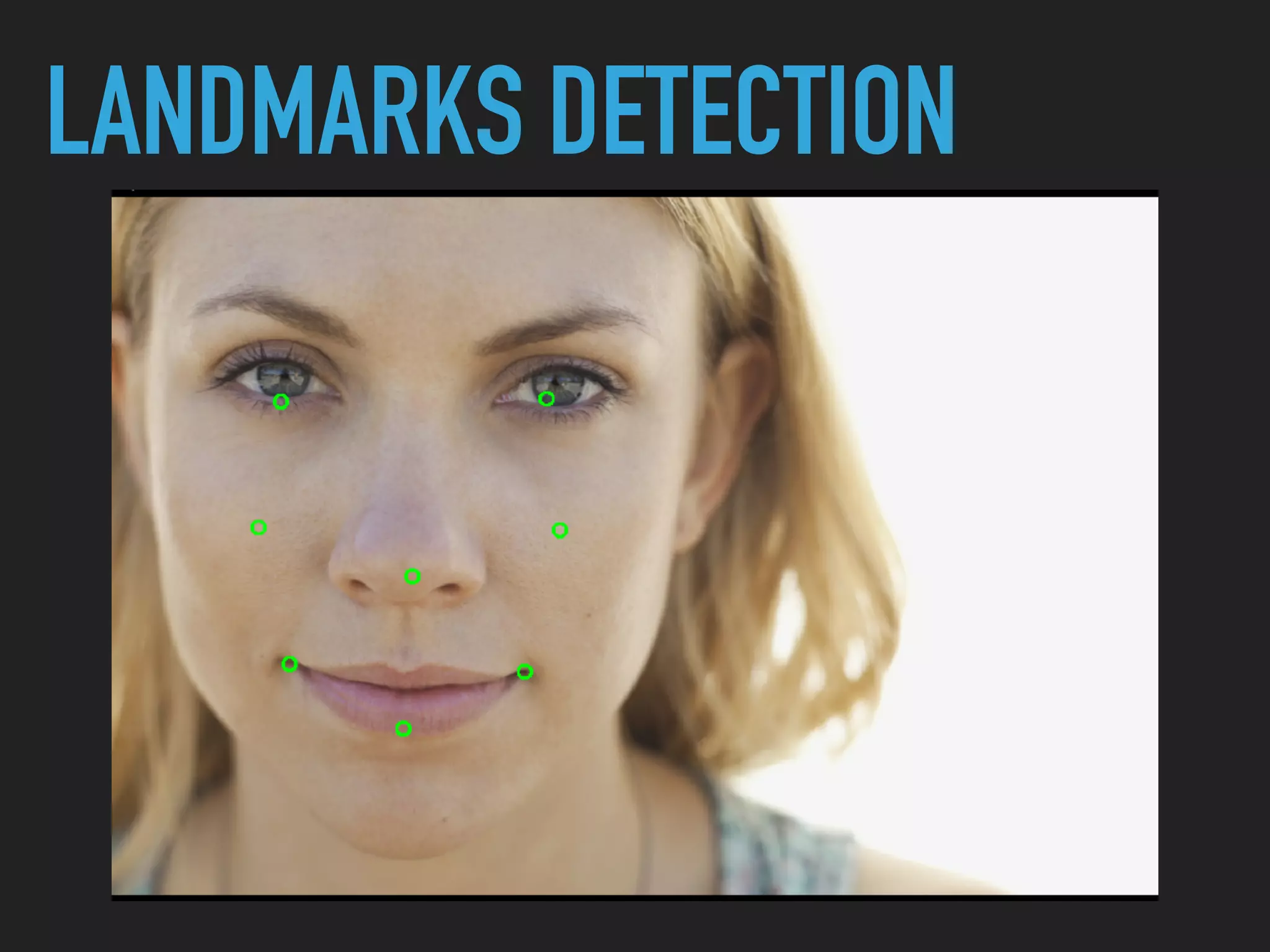 LANDMARKS DETECTION
 