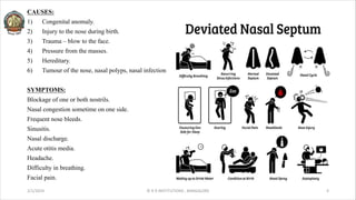 CAUSES:
1) Congenital anomaly.
2) Injury to the nose during birth.
3) Trauma – blow to the face.
4) Pressure from the masses.
5) Hereditary.
6) Tumour of the nose, nasal polyps, nasal infection.
SYMPTOMS:
Blockage of one or both nostrils.
Nasal congestion sometime on one side.
Frequent nose bleeds.
Sinusitis.
Nasal discharge.
Acute otitis media.
Headache.
Difficulty in breathing.
Facial pain.
2/1/2024 © R R INSTITUTIONS , BANGALORE 4
 