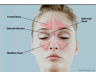 Sept Nazal DEVIATED NASAL SEPTUM BY BHUMIKA.G.THAKOR | PPTX