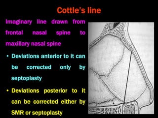 Deviated nasal septum and other septal conditions | PPT