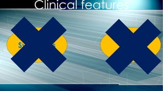 Clinical features
Symptoms Signs
 