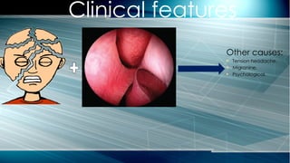 Other causes:
 Tension headache.
 Migranine.
 Psychological.
Clinical features
 